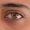 Cataract-Picture